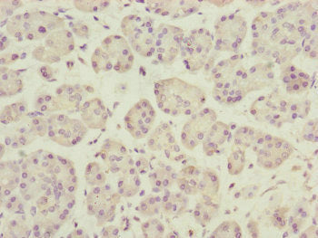 DCTN3 Antibody