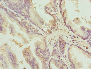 DEDD Antibody
