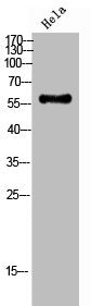 Phospho-CHEK2 (T387) Antibody