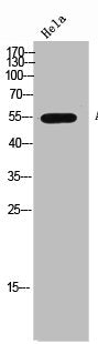 CHRNB1 Antibody