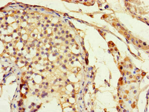 DLX5 Antibody