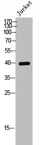 Phospho-CCR5 (S336) Antibody