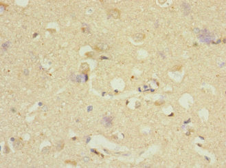DNAJB2 Antibody