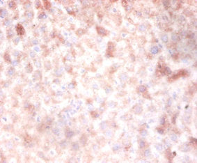 DNMT3A Antibody