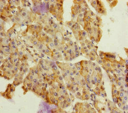 DPT Antibody
