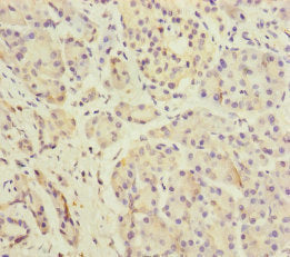 DPT Antibody