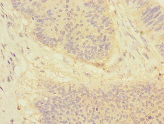 DSC1 Antibody