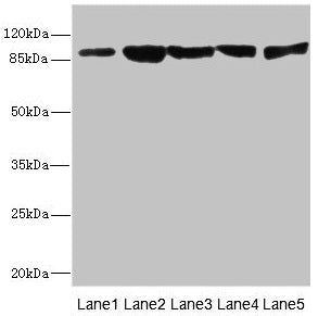 DSC2 Antibody