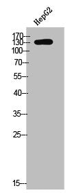 Phospho-CSF1R (Y561) Antibody