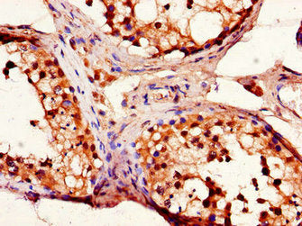 EFEMP1 Antibody