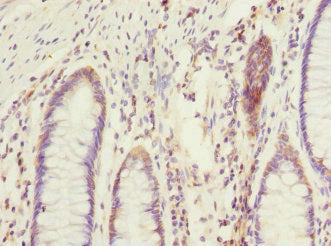 EIF2B2 Antibody