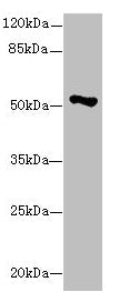 EIF2S3 Antibody