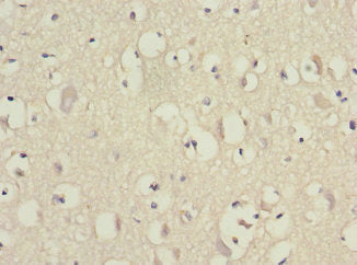 EIF3F Antibody