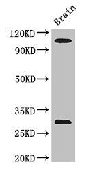 EPHA1 Antibody
