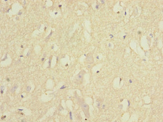 EPHB1 Antibody