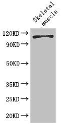 EPHB6 Antibody