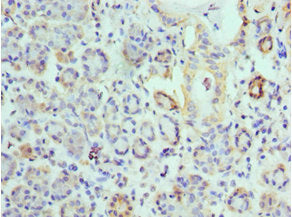 EPM2A Antibody