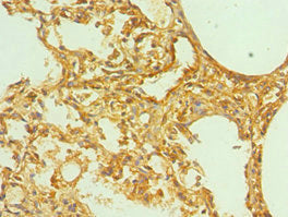 ERBB3 Antibody