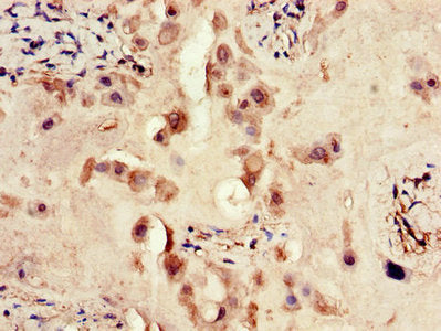 ERBB4 Antibody