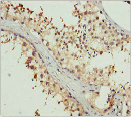ERLIN2 Antibody