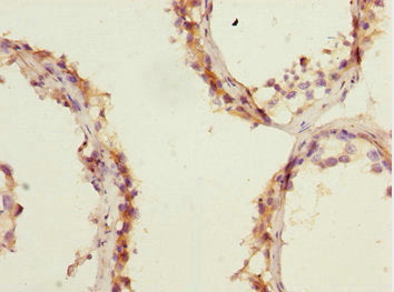 ERMP1 Antibody