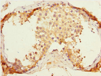 ERMP1 Antibody