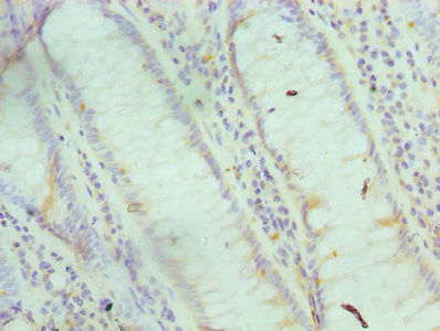 FABP6 Antibody