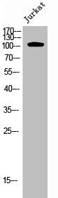 Phospho-EPHA7 (Y791) Antibody