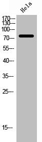 ABCD1 Antibody