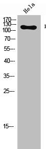 Phospho-FGFR1 (Y654) Antibody