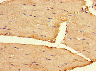 RIPOR2 Antibody
