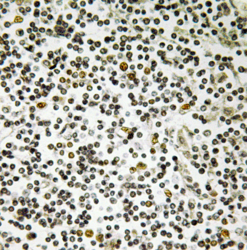 CEP152 Antibody