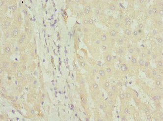 FASTK Antibody