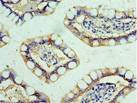 FBXW4 Antibody