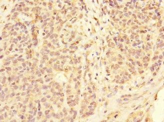 FCGR2C Antibody