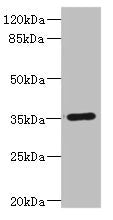 FCGR2C Antibody