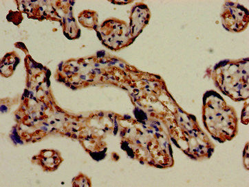 FCGR3A Antibody