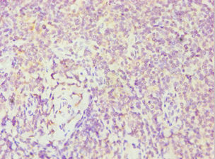 FES Antibody