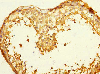 FGF12 Antibody