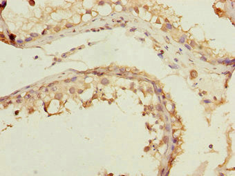 FOXN2 Antibody