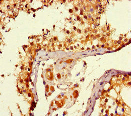 MTOR Antibody