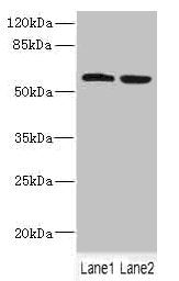 FTCD Antibody