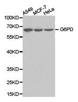 G6PD Antibody