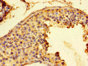 G6PD Antibody