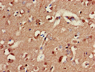 GABRA2 Antibody