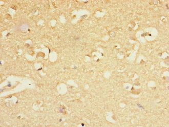 GABRA5 Antibody