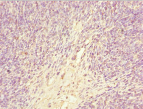 GABRR1 Antibody