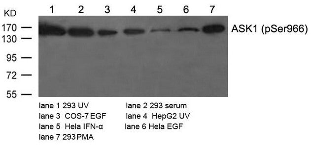 Phospho-MAP3K5 (Ser966) Antibody