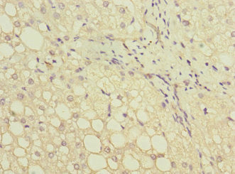 GATC Antibody