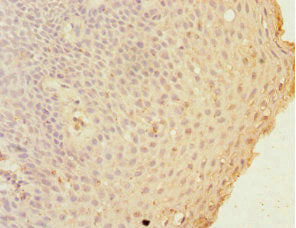 GCA Antibody